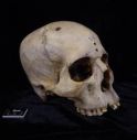 Ricerca, su cranio egiziano di 4mila anni i segni della prima chirurgia anticancro.