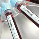 Coronavirus: Veneto, + 109 contagi, nessuna vittima