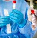 Coronavirus, balzo in avanti dei contagi in Veneto: 55 nuovi casi