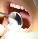  A Miane visite dentistiche gratis per bambini e ragazzi