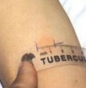 Tubercolosi al Duca degli Abruzzi di Treviso: martedì test per 180 studenti