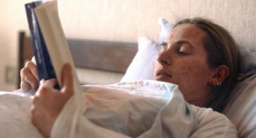 Morbillo in Italia, il Ministero: 
