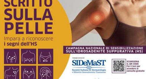 Idrosadenite suppurativa, al via campagna di sensibilizzazione 'Scritto sulla pelle'.