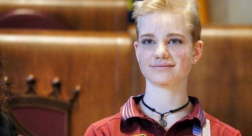 Beatrice Vio