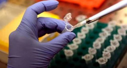 Morbillo, Pennsylvania segnala sesto morto: 39enne con patologie e già infettata di recente.
