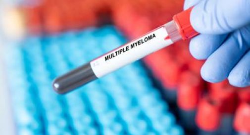 Mieloma multiplo, remissione a 5 anni con terapia Car-T cilta-cel in linee precoci.